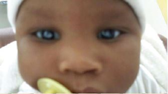 samantha before surgery